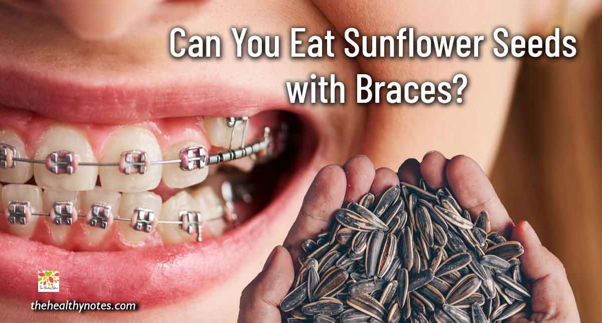 can you eat sunflower with braces?